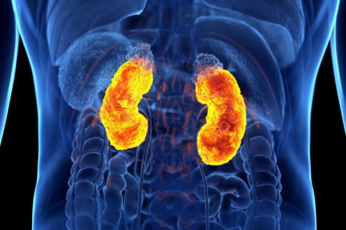 6 Faktor yang Menyebabkan Gagal Ginjal Selain Darah Tinggi Diabetes dan Tekanan Darah Tinggi, Pemicu Gagal Ginjal yang Diabaikan